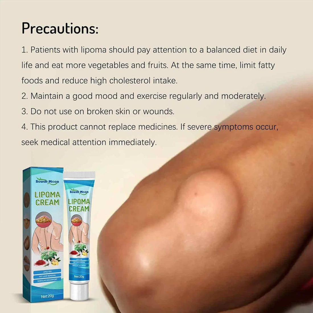 🔥2026 HOT SALE South Moon™ Lipoma Treatment Ointment