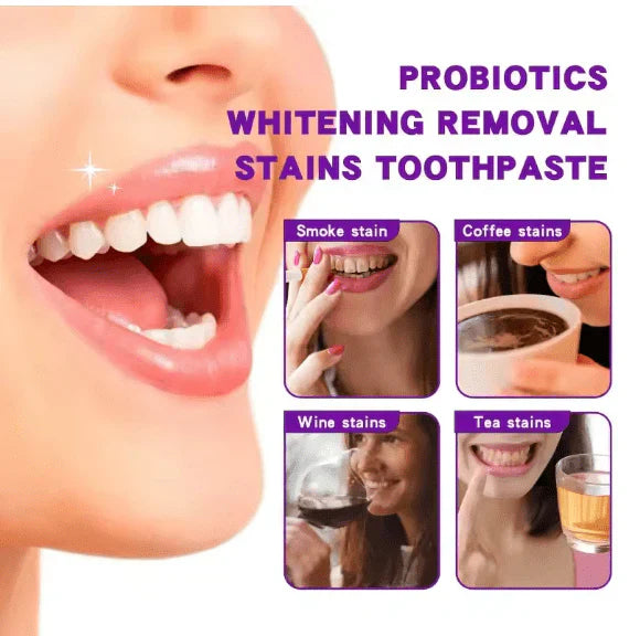 LAST DAY OF DISCOUNT 🔥 SP7 WHITENING TOOTHPASTE