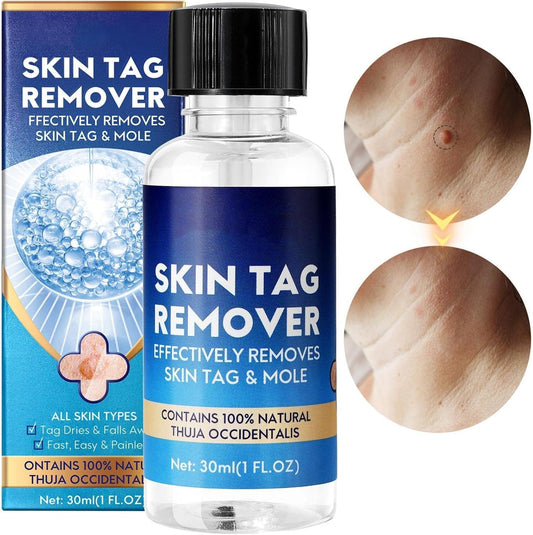LAST DAY OF DISCOUNT 🔥 Mole and wart removal cream