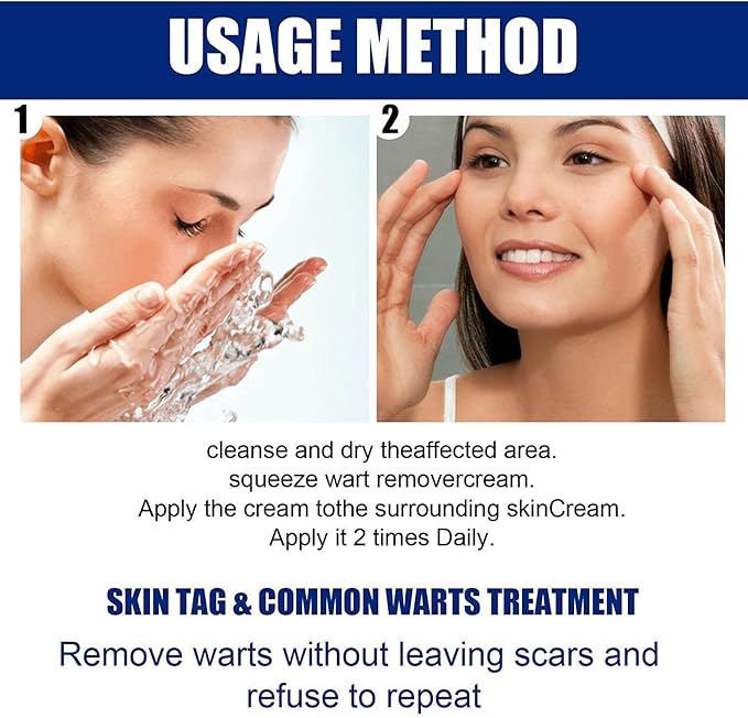 🔥 Last Day Of Discount! Wart Remover Instant Blemish Removal Cream 🛒✨